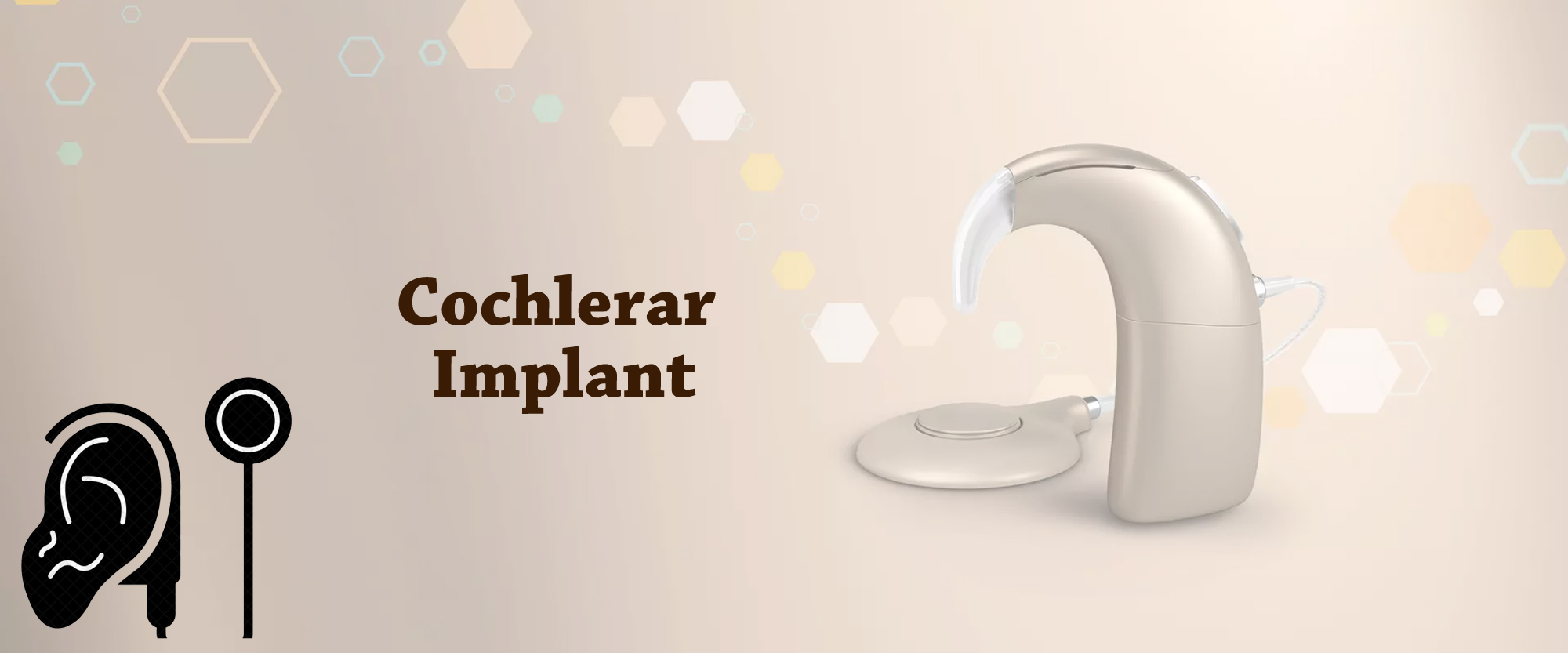 Cochlear Implant